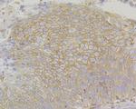 PD-L1 (CD274) Antibody in Immunohistochemistry (Paraffin) (IHC (P))