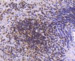 STAT5 alpha/beta Antibody in Immunohistochemistry (Paraffin) (IHC (P))