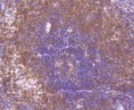 MEK3/MEK6 Antibody in Immunohistochemistry (Paraffin) (IHC (P))