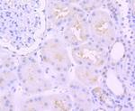 PAX8 Antibody in Immunohistochemistry (Paraffin) (IHC (P))