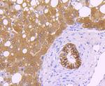 Carbonic Anhydrase IX Antibody in Immunohistochemistry (Paraffin) (IHC (P))