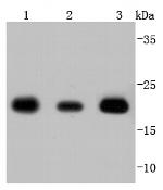 SOD2 (MnSOD) Antibody in Western Blot (WB)