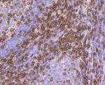 CD3d Antibody in Immunohistochemistry (Paraffin) (IHC (P))