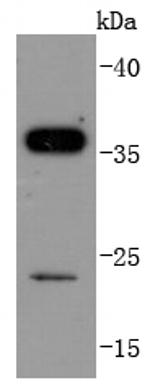 SIRT5 Antibody in Western Blot (WB)