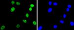 ARID1A Antibody in Immunocytochemistry (ICC/IF)