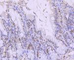 ARID1A Antibody in Immunohistochemistry (Paraffin) (IHC (P))