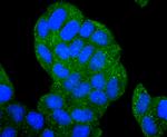 HDAC6 Antibody in Immunocytochemistry (ICC/IF)