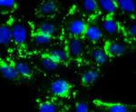 HDAC6 Antibody in Immunocytochemistry (ICC/IF)