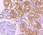 HDAC6 Antibody in Immunohistochemistry (Paraffin) (IHC (P))