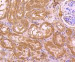 Cdc45L Antibody in Immunohistochemistry (Paraffin) (IHC (P))