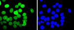 E2F1 Antibody in Immunocytochemistry (ICC/IF)