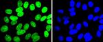 E2F1 Antibody in Immunocytochemistry (ICC/IF)