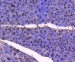 E2F1 Antibody in Immunohistochemistry (Paraffin) (IHC (P))