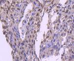 E2F1 Antibody in Immunohistochemistry (Paraffin) (IHC (P))