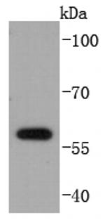 E2F1 Antibody in Western Blot (WB)