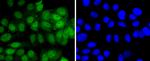 4EBP1 Antibody in Immunocytochemistry (ICC/IF)