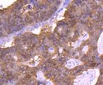 4EBP1 Antibody in Immunohistochemistry (Paraffin) (IHC (P))