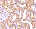 FUS Antibody in Immunohistochemistry (Paraffin) (IHC (P))