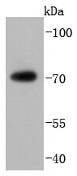 FUS Antibody in Western Blot (WB)