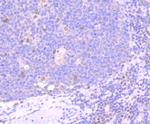 BMI-1 Antibody in Immunohistochemistry (Paraffin) (IHC (P))