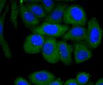 Fas Antibody in Immunocytochemistry (ICC/IF)