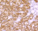 EBP50 Antibody in Immunohistochemistry (Paraffin) (IHC (P))