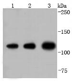 IDE Antibody in Western Blot (WB)