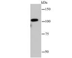 IDE Antibody in Western Blot (WB)