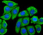 CD206 (MMR) Antibody in Immunocytochemistry (ICC/IF)