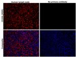 CD206 (MMR) Antibody in Immunohistochemistry (Paraffin) (IHC (P))