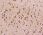 CD71 (Transferrin Receptor) Antibody in Immunohistochemistry (Paraffin) (IHC (P))