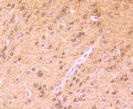 Phospho-PKC alpha (Thr638) Antibody in Immunohistochemistry (Paraffin) (IHC (P))