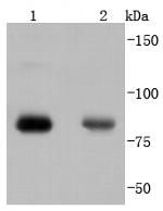 Phospho-PKC alpha (Thr638) Antibody in Western Blot (WB)