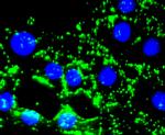 Fibronectin Antibody in Immunocytochemistry (ICC/IF)