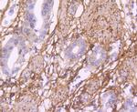 Fibronectin Antibody in Immunohistochemistry (Paraffin) (IHC (P))