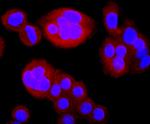 TK1 Antibody in Immunocytochemistry (ICC/IF)
