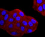 gamma Tubulin Antibody in Immunocytochemistry (ICC/IF)