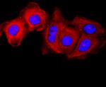 gamma Catenin Antibody in Immunocytochemistry (ICC/IF)