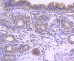 Phospho-SMAD2 (Ser255) Antibody in Immunohistochemistry (Paraffin) (IHC (P))