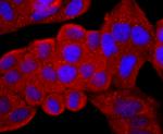 CD99 Antibody in Immunocytochemistry (ICC/IF)