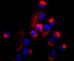 CD99 Antibody in Immunocytochemistry (ICC/IF)