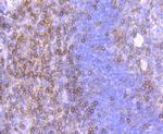 CD99 Antibody in Immunohistochemistry (Paraffin) (IHC (P))