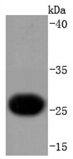 Cardiac Troponin I Antibody in Western Blot (WB)