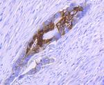 S100A10 Antibody in Immunohistochemistry (Paraffin) (IHC (P))