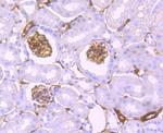 S100A10 Antibody in Immunohistochemistry (Paraffin) (IHC (P))