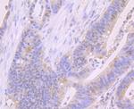 FOXP1 Antibody in Immunohistochemistry (Paraffin) (IHC (P))