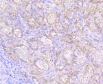 Dysferlin Antibody in Immunohistochemistry (Paraffin) (IHC (P))