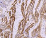 Dysferlin Antibody in Immunohistochemistry (Paraffin) (IHC (P))