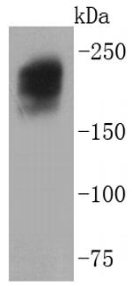 Dysferlin Antibody in Western Blot (WB)