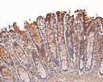 Galectin 3 Antibody in Immunohistochemistry (Paraffin) (IHC (P))